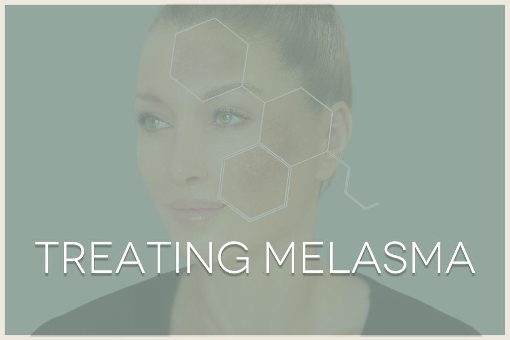 Treating melasma (model face with dark pigmentation)