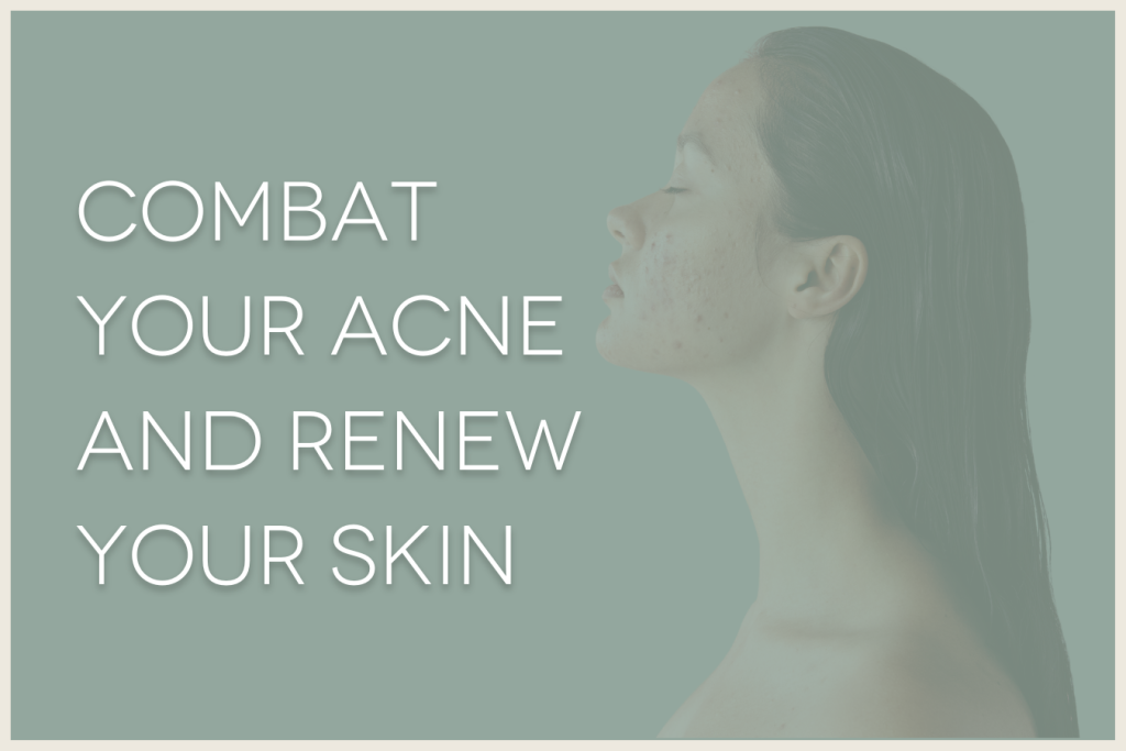 combat your acne and renew your skin