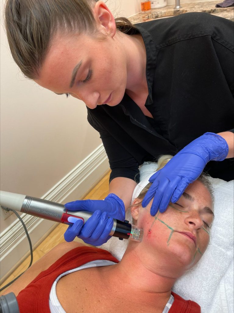 We also offer Genius® RF Microneedling